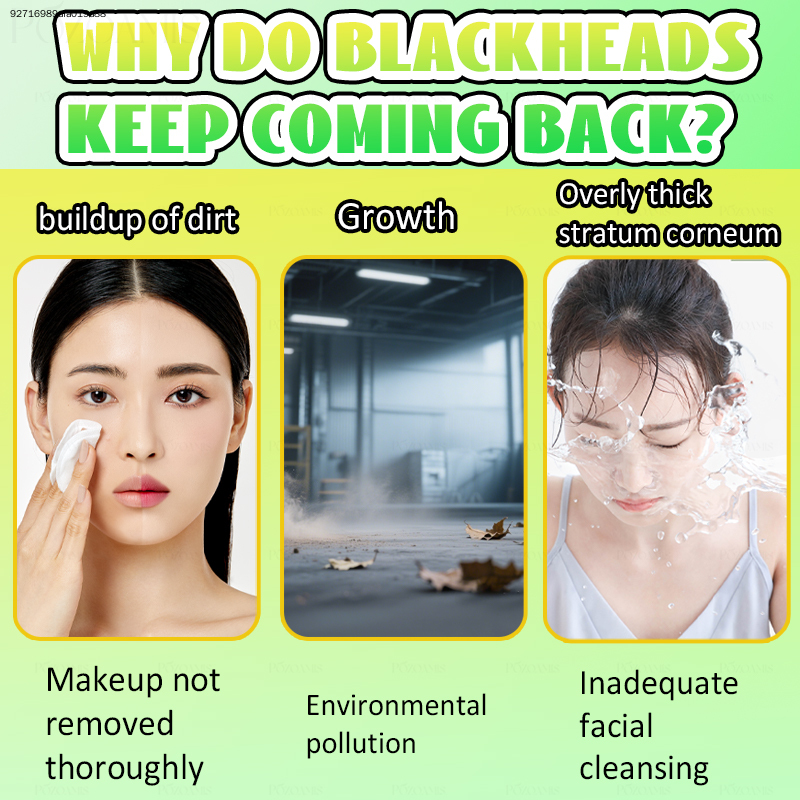 POZOAMIS Deep Pore Cleansing F - Skincare Oily Skin ulasan dan harga